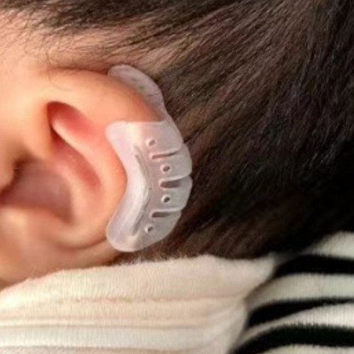 Ear orthopaedic patch - ear,